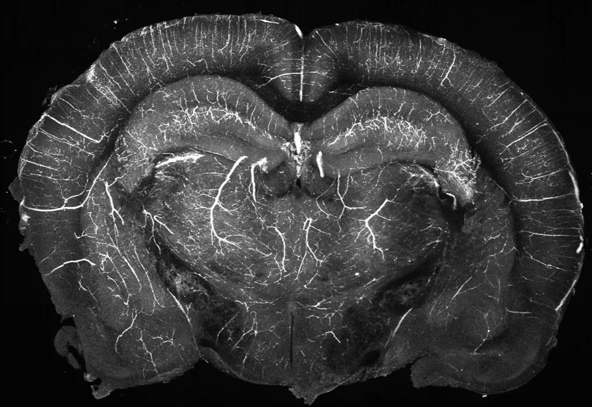 example section from blood vessel labelled brain, in vitro (projected in AP axis across 500um)