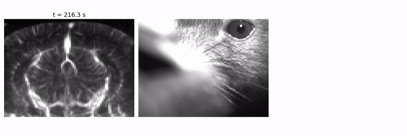 Example motion in a awake, head-fixed mouse while the animal moves. Deformations are more visible in deep parts of the brain.