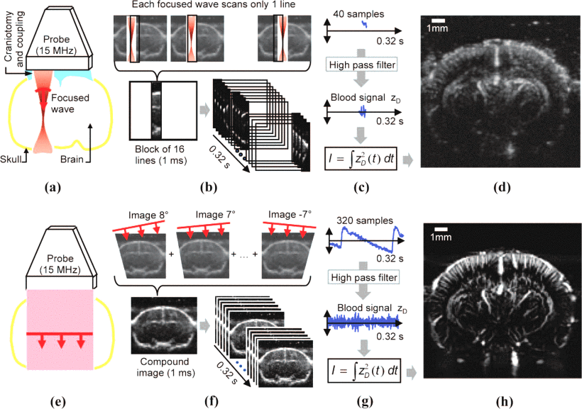 Figure from Mace et al, 2013 [1] showing the comparison between conventional (a-d) and ultrafast (e-h) doppler imaging.